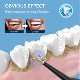 Electric Sonic Dental Plaque/Tartar Scaler & Calculus Stain Remover - Generu - Generu